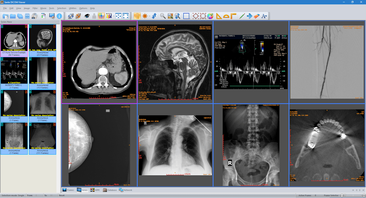 dicom viewer for mac free download